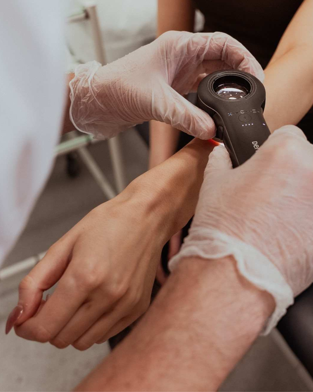 Looking Closer: Why Dermoscopy Matters