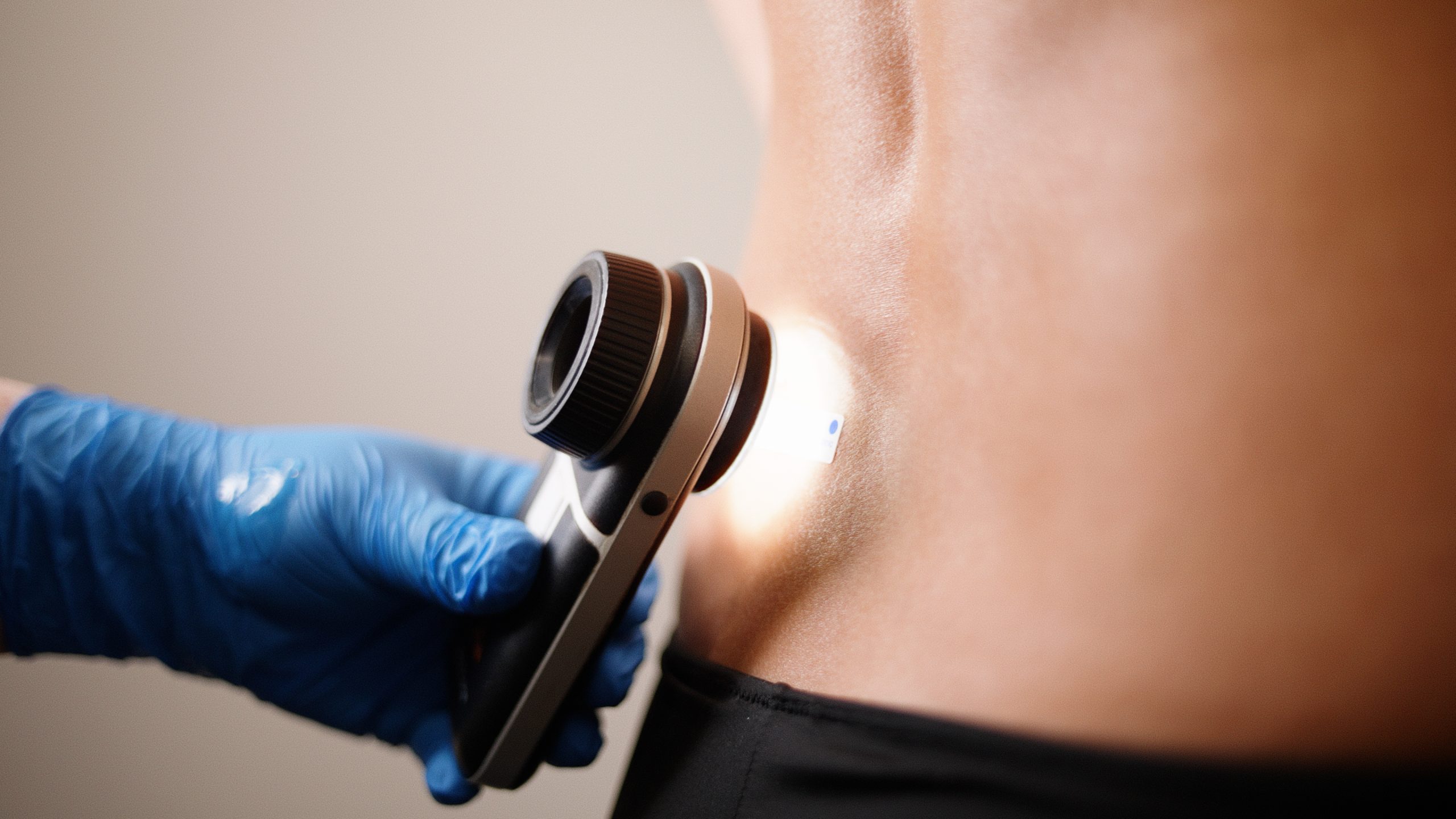 A dermatoscope held against skin during an examination